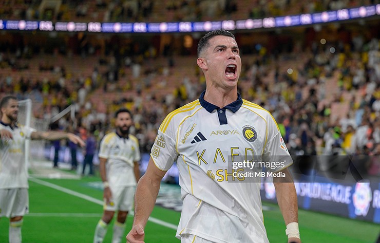 Cristiano Ronaldo thừa nhận nỗi ám ảnh hói đầu dù vẫn ở đỉnh cao phong độ