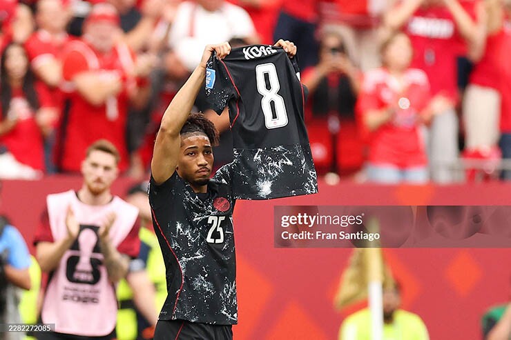 Kinh hoàng World Cup 2026: Sao Canada gãy chân, đau đớn chia tay người hâm mộ - 9